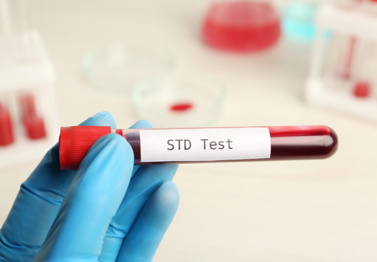 Eine Person hält ein Blutteströhrchen mit der Aufschrift „STD-Test“.